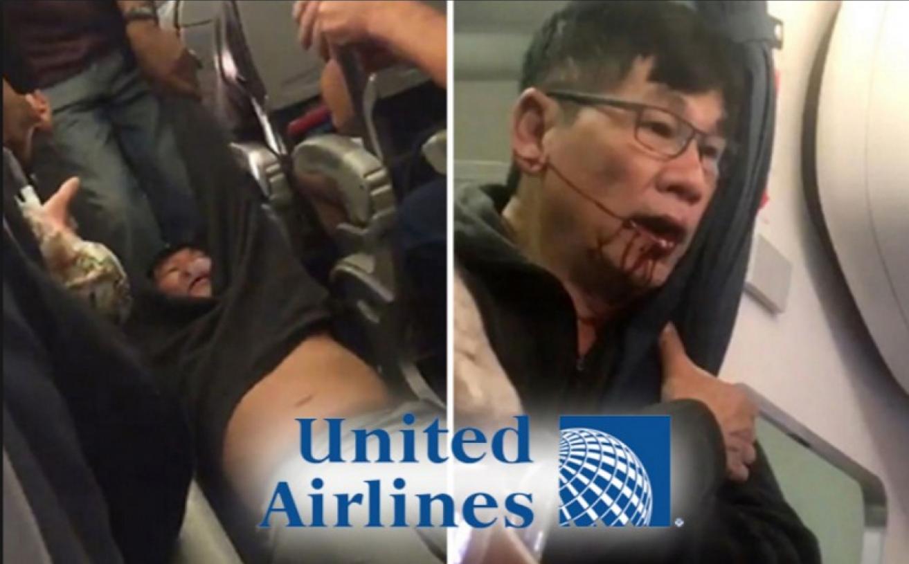 The CEO of United Airlines Apologized